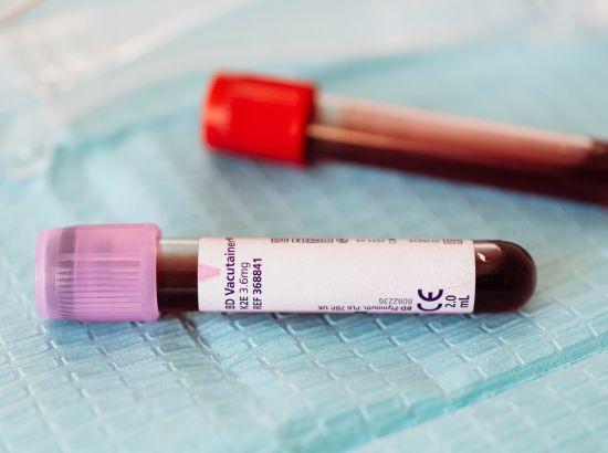 ਤਸ਼ੱਦਦ ਦੇ ਸਾਏ ਹੇਠ ਫ਼ੈਲ ਰਿਹਾ ਅਨੀਮੀਆ -ਗੁਰਮੀਤ ਸਿੰਘ ਪਲਾਹੀ